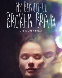 Khối óc xinh đẹp tội nghiệp của tôi | My Beautiful Broken Brain (2016) Khối óc xinh đẹp tội nghiệp của tôi | My Beautiful Broken Brain (2016)